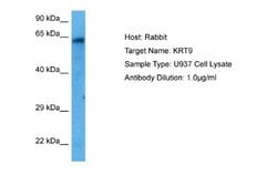 KRT9 Rabbit anti-Human, Polyclonal, Novus Biologicals 0.1 mL | Buy Online | Novus Biologicals | Fisher Scientific